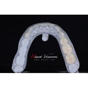 Buy cheap Ultra thin cast porcelain veneer from wholesalers