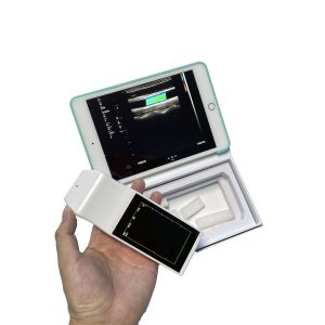 China Wireless Linear Probe High Frequency Probe Special Tool for Visual Puncture Guidance Integrated Handheld Ultrasound Scanner on sale China Wireless Linear Probe High Frequency Probe Special Tool for Visual Puncture Guidance Integrated Handheld Ultrasound Scanner on sale
