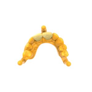 Flexible Clear Permanent Crown Resin for Dental Restorations