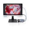 Laparoscopy Cystoscope Surgeries 24 HD Endoscopy LED Light Source Endoscope Camera With Record Function for sale