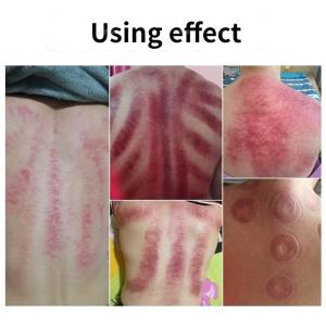 Buy cheap Full Body Scraping Cupping Massager Back Vacuum Massage Machine For Cellulite Removal from wholesalers