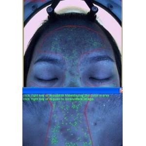 Buy cheap RGB Moisture Skin Analyzer Machine , Moisture Analysis with 3D Function from wholesalers