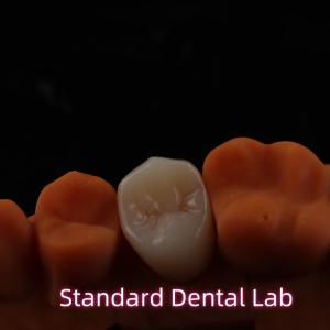 Buy cheap High Esthetic BruxZir Full Contour Zirconia Crowns PFZ Bridge from wholesalers
