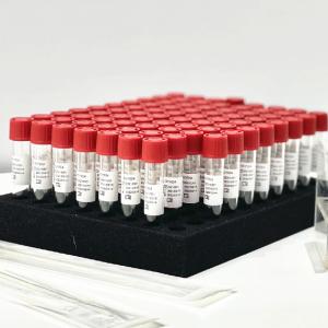 Pharynx Nasal Swab Sample Release Reagent Extraction Kit 0.5mL/ Tube Without