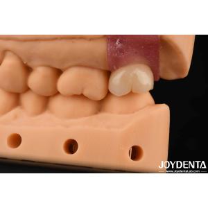 Buy cheap 4.1mm V Shaped Thread Titanium Abutments With Internal Hex Connection from wholesalers