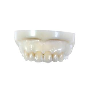 Buy cheap Zirconia All-Ceramic Teeth Crowns & Bridges from wholesalers