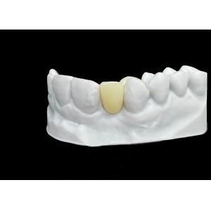 Buy cheap Chipping Resistance Zirconia dental Crown With Exceptional Strength And Translucency from wholesalers
