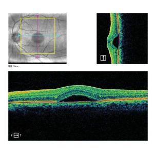 Buy cheap Macular Disease Optical Coherence Tomography System PC Inside from wholesalers