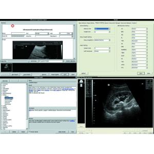 Popular 3D Digital Laptop Veterinary Ultrasound Scanner Lightweight Easy To