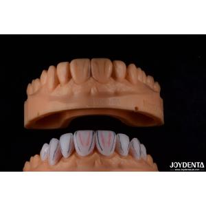 Buy cheap Custom Made Dental Emax Ceramic Veneers With Stain Resistance High Gloss product
