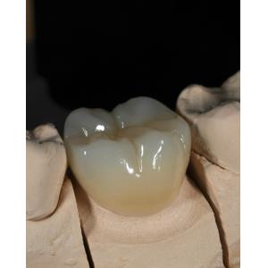 Full Contour Zirconia Crown Quick Turnaround for Precise and Aesthetic Fit in 1