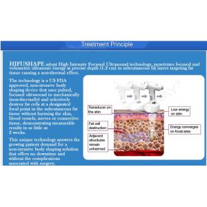 Buy cheap Ultrashape technology!!! 2017 hifu body contouring slimming machine nubway from wholesalers