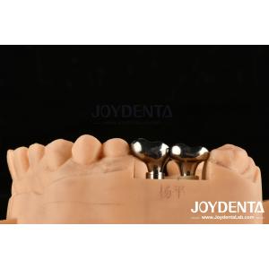 Buy cheap Silver Dental Implant Abutments Customizable Diameter Height CAD CAM Technology from wholesalers