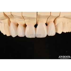 Buy cheap Highly Customizable Layered Zirconia Dental Crowns And Bridges Long Lasting product