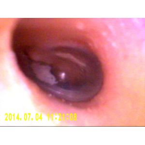 SD Card Storage ENT Diagnostic Equipment Otoscope Ophthalmoscope Automatically