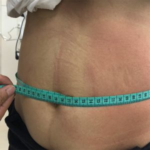 80Kpa Cool Sculpting Cryolipolysis Fat Freezing Machine