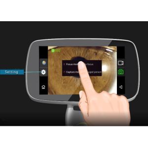 Anterior Segment Imaging 10X 16MP Hand Held Slit Lamp