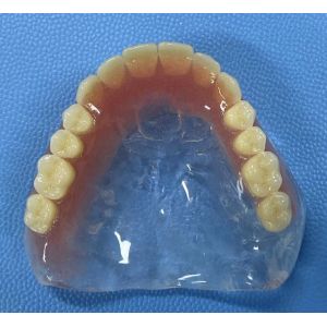 Easy To Clean Full Acrylic Denture Highly Elastic for long term use