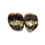 Buy cheap High Strength FMC Metal Crown Tooth Semi Precious Metal Crown from wholesalers