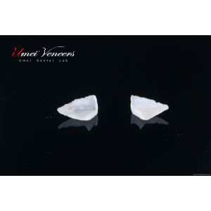 Buy cheap Customized ultra-thin dental veneer product