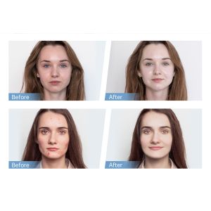 Buy cheap Latest 4-Pole EMS Automatcal Serum Applicator Hydra Pen H5 Face Skin Derma Microneedling Pen Essence Collagen Regeneration from wholesalers