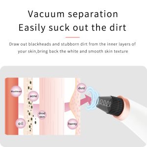 Buy cheap Suction Pore Cleaner Blackhead Extraction Machine Portable Electronic Multi Function from wholesalers