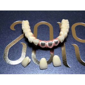 Buy cheap Smooth Surface Biocompatible Zirconia Tooth Crown Easy Maintain from wholesalers