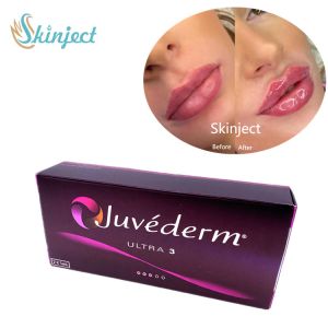 Buy cheap Juvederm Ultra3 2x1ml Hyaluronic Acid Facial Fillers Dermal from wholesalers