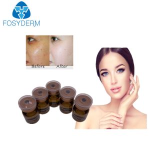 Buy cheap 20mg/ml 5ml Mesotherapy Serum Whitening Meso Solution from wholesalers
