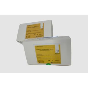 China Labnovation SARS-CoV-2 Antigen Rapid Test Kit Qualitative Detection One Step on sale China Labnovation SARS-CoV-2 Antigen Rapid Test Kit Qualitative Detection One Step on sale