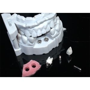 Natural-looking Zirconia Dental Crown with Excellent Biocompatibility and