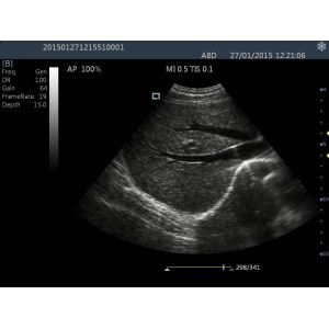 Buy cheap Portable Ultrasound Scanner Color Doppler Machine With 15 Inch LCD Monitor from wholesalers