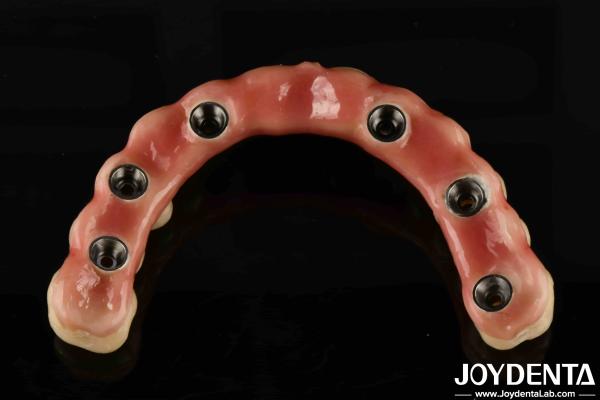 Quality Adjustable Titanium Malong Hybrid Bridge Perfect Combination Of Traditional And Modern Techniques for sale