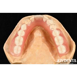 Buy cheap Diverse And Lightweight Resin Material Acrylic Denture Finish from wholesalers