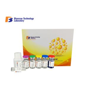 China Ica Sandwich Human Elisa Kit , Iso9001 2005 Approval Enzyme Immunoassay Kit on sale