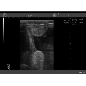 Hydra Derma Roller Stamp Needle 20 Microneedling Get Serums Into Skin Gold