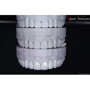 Buy cheap Strong and thin aesthetic veneers product