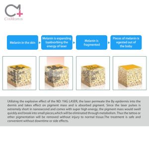 Buy cheap Stationary Eye Brow Tattoo Removal Machine for 2022 Technology Featuring Nd Yag Laser from wholesalers