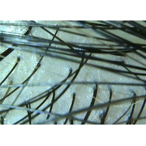 Buy cheap Manual Focus Wireless Digital Skin Analyzer Microscope for Hair and Skin with Resolution of 1920*1080P from wholesalers