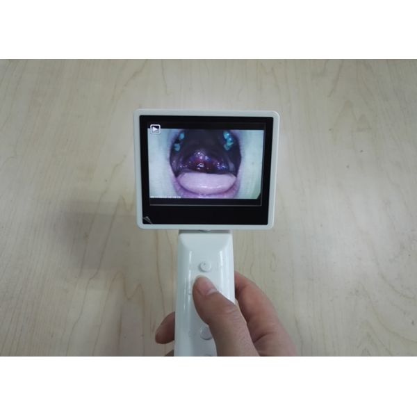 SD Card Storage ENT Diagnostic Equipment Otoscope Ophthalmoscope Automatically