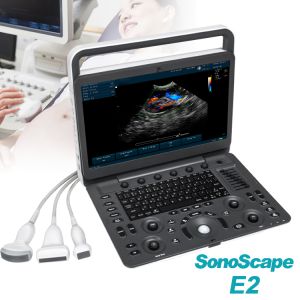 Buy cheap Doppler Color Ultrasonic Ultrasonido Portatil SonoScape E2 from wholesalers