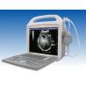 Buy cheap 12 " LCD Screen Portable Ultrasound Device Digital High Resolution With B, B+B, 4B, B/M M Modes from wholesalers