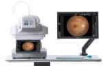 Automated Fundus Camera Clear Fundus Image Automated Focus 24 Megapixel