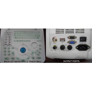 Buy cheap 4d Ultrasound Machine Portable Ultrasound Scanner With 120G Capacity 4800 Frames​ Cine Loop from wholesalers