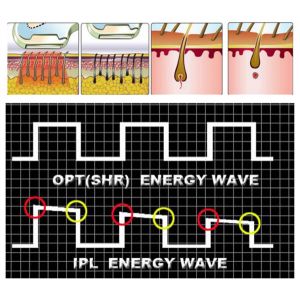 2015 multifunction ssr shr permanent laser hair removal machine