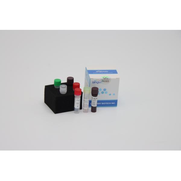 China Laboratory Multiplex Fast Real Time RT PCR Detection Kit Reagents For Sars Virus Detection on sale China Laboratory Multiplex Fast Real Time RT PCR Detection Kit Reagents For Sars Virus Detection on sale
