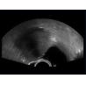 Buy cheap Pocket Wireless Hand Ultrasound Machine Android Windows IOS System Available from wholesalers