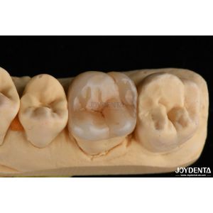 Buy cheap Natural Looking Emax Inlay Onlay Long Lasting Dental Restoration 0.5mm 1mm 1.5mm Thick from wholesalers