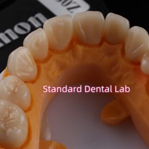 Buy cheap Dental Strong Layered Zirconia Crowns Full Upper Arch Restoration from wholesalers