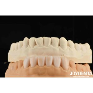Lightweight Property Flexible Denture Finish Personalized Customization For